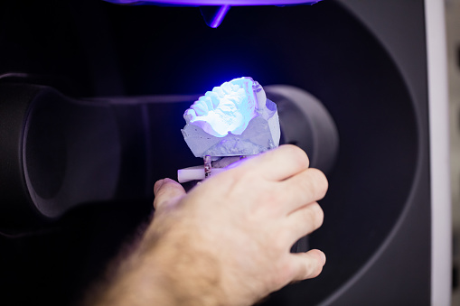 A dentist holding up teeth impression for a 3D scan in San Jose