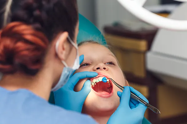 Young boy patiently keeping his mouth open while a dental assistant applies fluoride solution to his teeth.