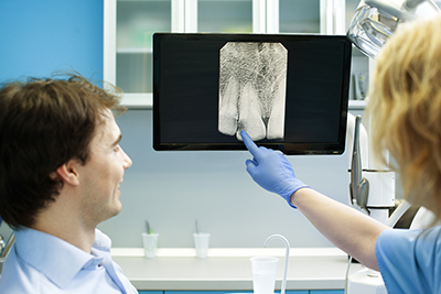When Would a Panoramic X-ray Be the Best Tool to Use?